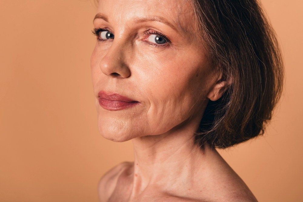 Radiesse is ideal for women 40+