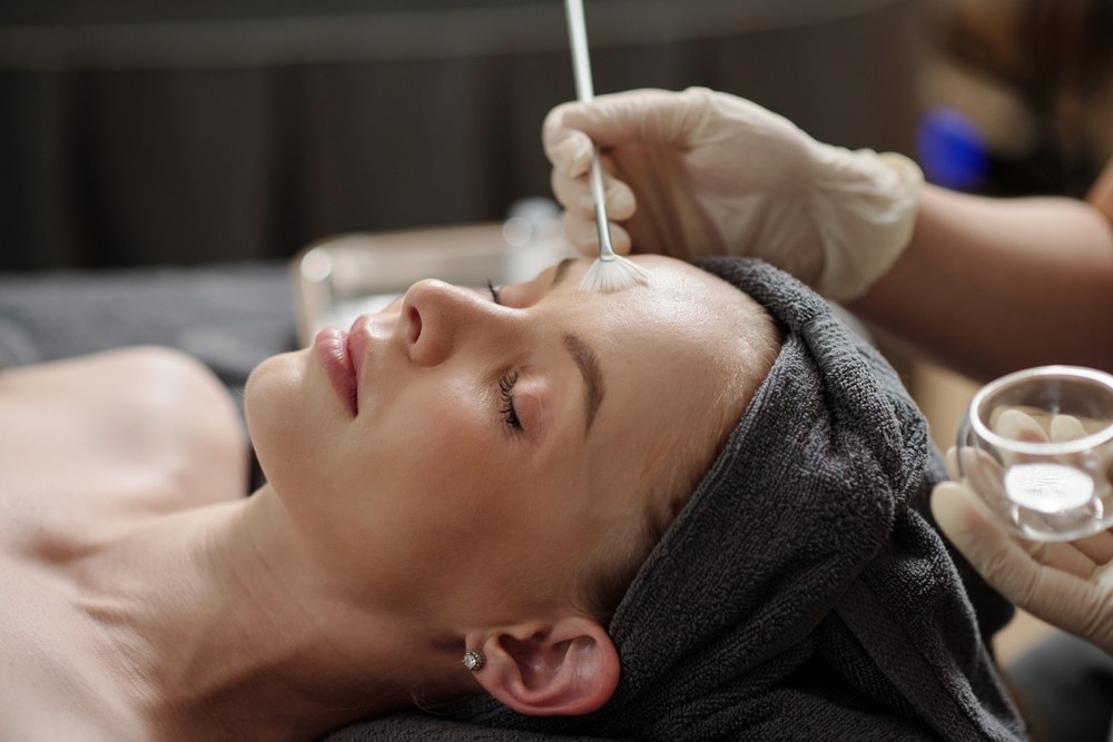 Chemical Peels Treatment